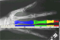 Bones in the hand demonstrating fibonacci's sequence 