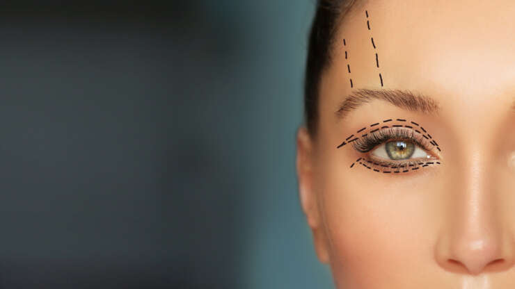 Blepharoplasty Vancouver: Achieving a More Youthful Look with Eyelid Surgery