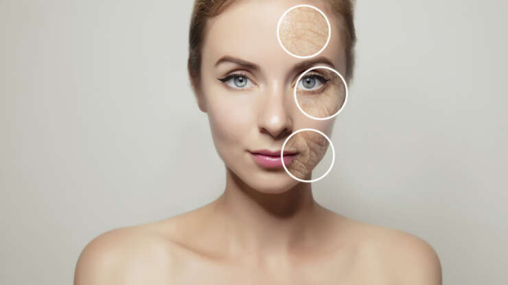Get Botox in Vancouver: Turn Back the Clock on Wrinkles