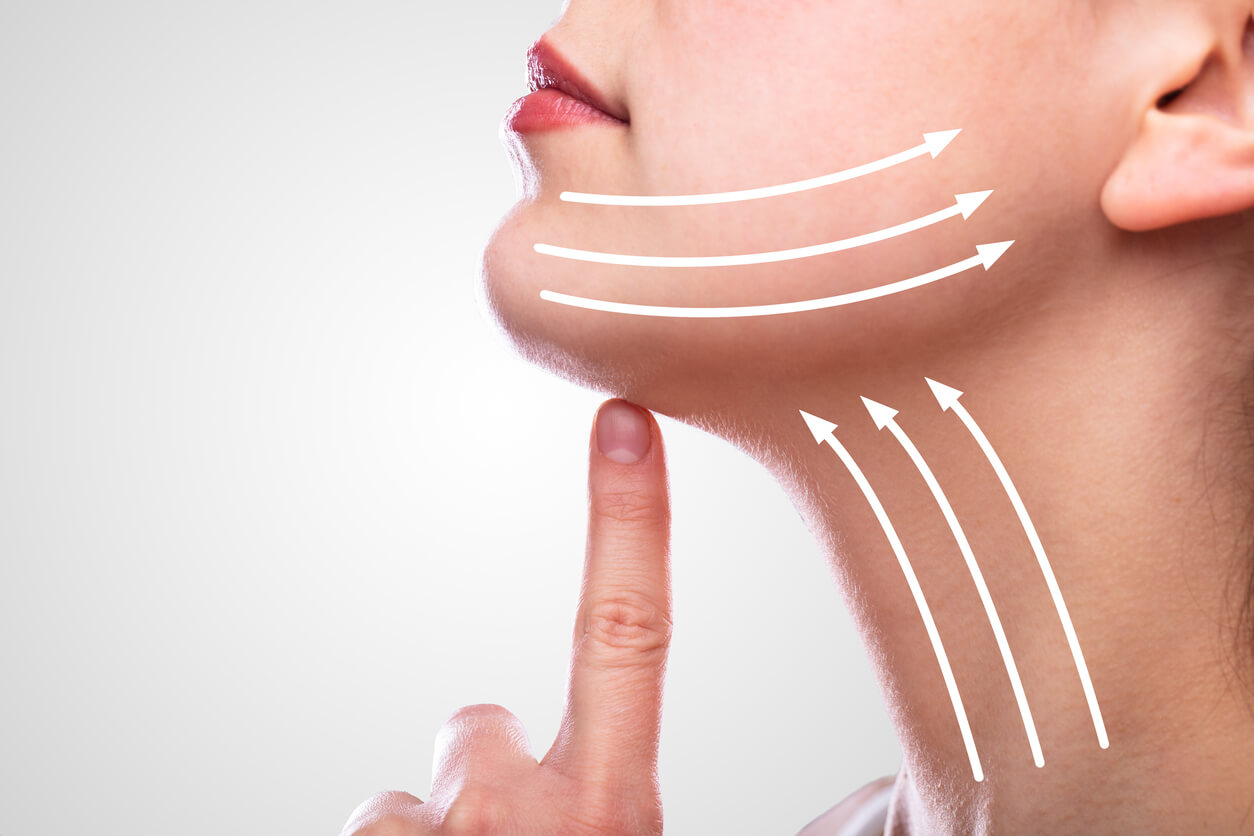 Woman With Arrows On Her Face Over White Background suggesting need for neck lift / submentoplasty procedures