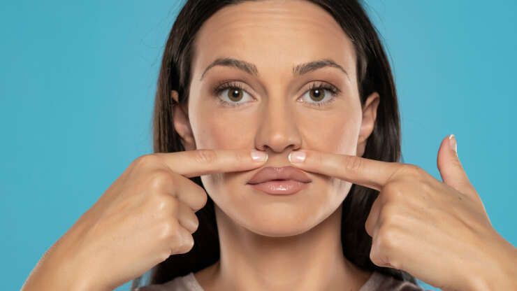 The Subnasal Lip Lift (Upper Lip Lift): Your Path to a Youthful Smile